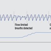 AirSense-algorithm-1