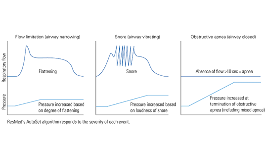 AutoSet_Technology_graph-1