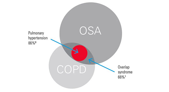 what-is-overlap-syndrome